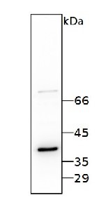RBP40 | 38 kDa RNA-binding protein in the group Antibodies Plant/Algal / Chlamydomonas reinhardtii at Agrisera AB (Antibodies for research) (AS14 2820)